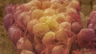 Fat tissue. Coloured scanning electron micrograph (SEM) of a sample of fat tissue, showing fat cells (adipocytes, red/yellow) surrounded by fine strands of supportive connective tissue. Adipocytes are among the largest cells in the human body, each cell being 100 to 120 microns in diameter. Almost the entire volume of each fat cell consists of a single lipid (fat or oil) droplet. Adipose tissue forms an insulating layer under the skin, storing energy in the form of fat, which is obtained from food. Magnification: x300 when printed 10 centimetres wide.